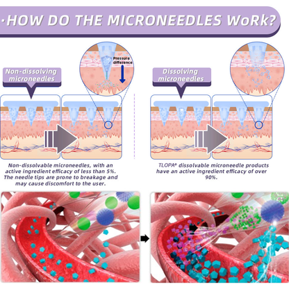 [See results in 7 days]✅ 𝐓𝐋𝗢𝐏𝐀® 𝐒𝐌𝐆𝗧-𝗚𝐋𝐏-1 Nano Microneedle Patch（Painless, long-lasting, addressing diabetes, obesity, and cardiovascular diseases）✨